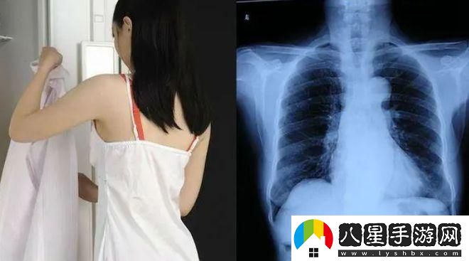 在醫學(xué)影像中