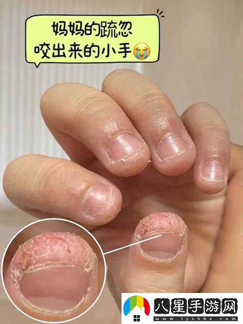 寶寶怎么才三根手指就痛