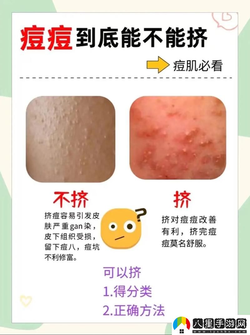 怎樣弄小痘痘才會(huì )渾身酥軟火爆上線(xiàn)